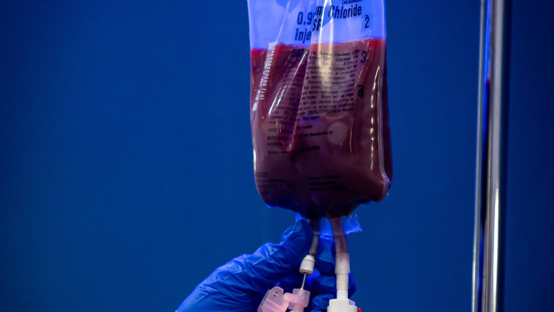Ozone UV IV therapy treatment